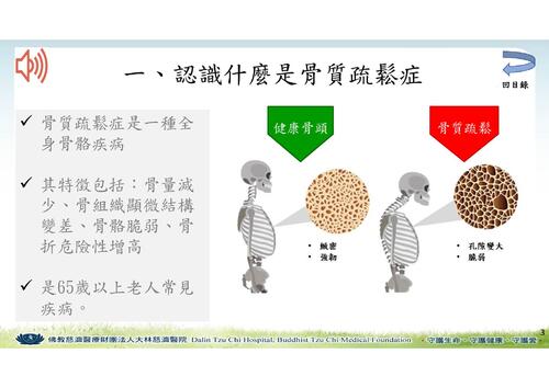 #電子書_骨鬆_昭妤_單頁_ok